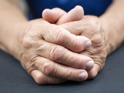 Is Rheumatoid Arthritis a Disability? | Find SSD Support