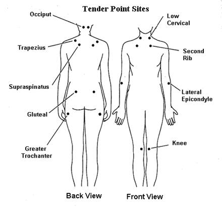 win fibromyalgia disability case Disability Apply lawyer houston texas